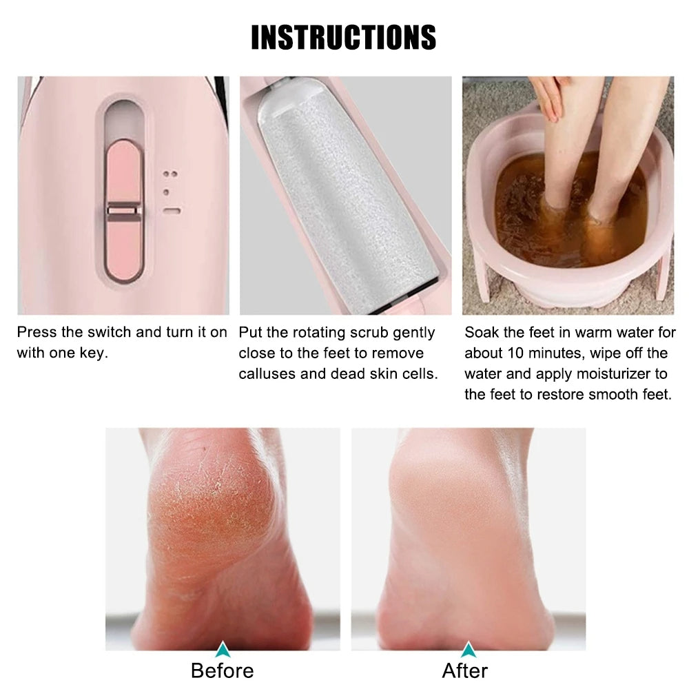 Digital Callus Remover (مزيل مسامير القدم الرقمي)