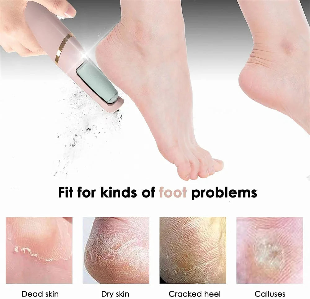 Digital Callus Remover (مزيل مسامير القدم الرقمي)
