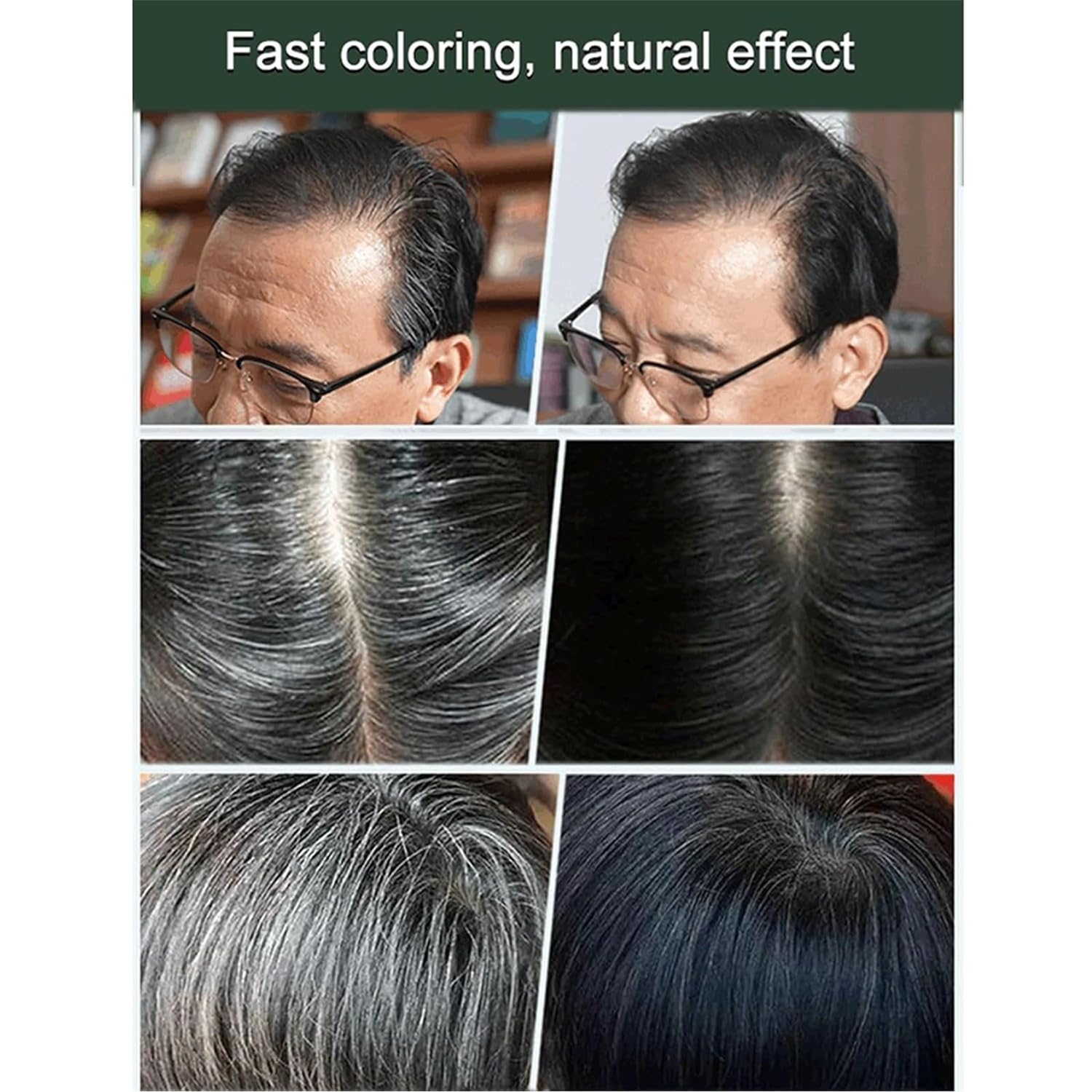 Natural Fruit Hair Dye for Men and Women All Hair Types (Black)